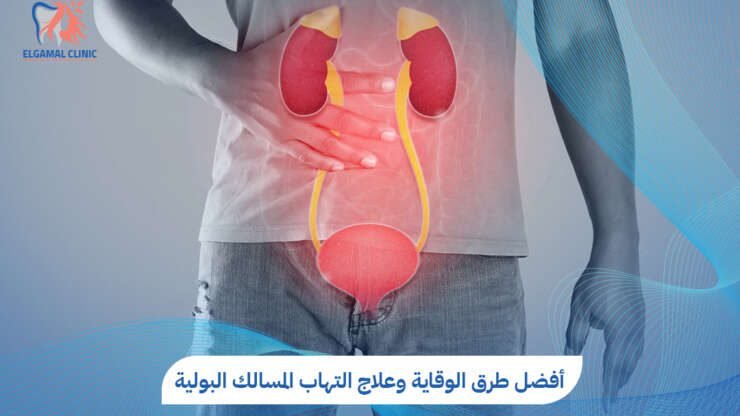 التهاب المسالك البولية: الأعراض والعلاج | عيادات الجمل