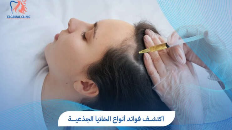 أنواع الخلايا الجذعية واستخدماتها | عيادات الجمل