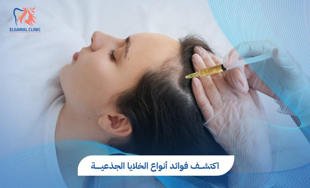 أنواع الخلايا الجذعية واستخدماتها | عيادات الجمل