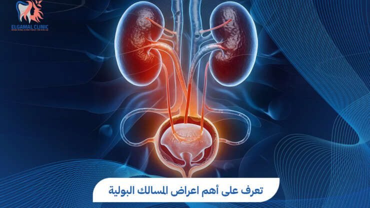 اعراض المسالك البولية: الأسباب والعلاج | عيادات الجمل
