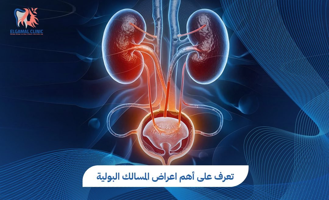 اعراض المسالك البولية: الأسباب والعلاج | عيادات الجمل
