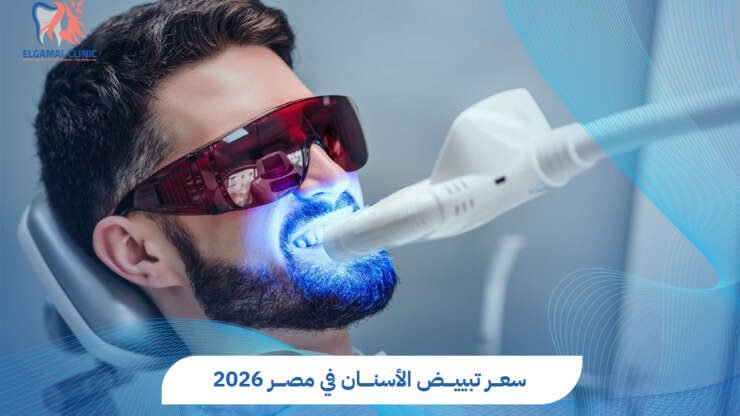 سعر تبييض الأسنان في مصر | التكلفة والنتائج
