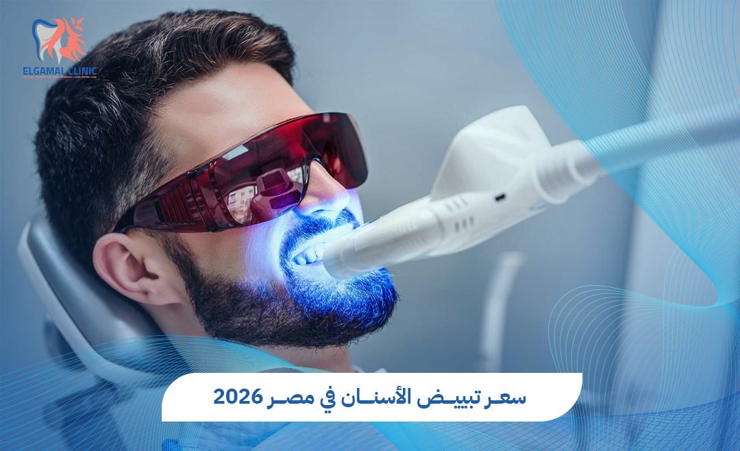 سعر تبييض الأسنان في مصر | التكلفة والنتائج