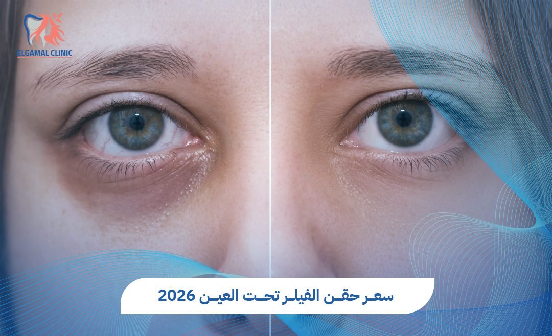 سعر حقن الفيلر تحت العين في مصر | عيادات الجمل