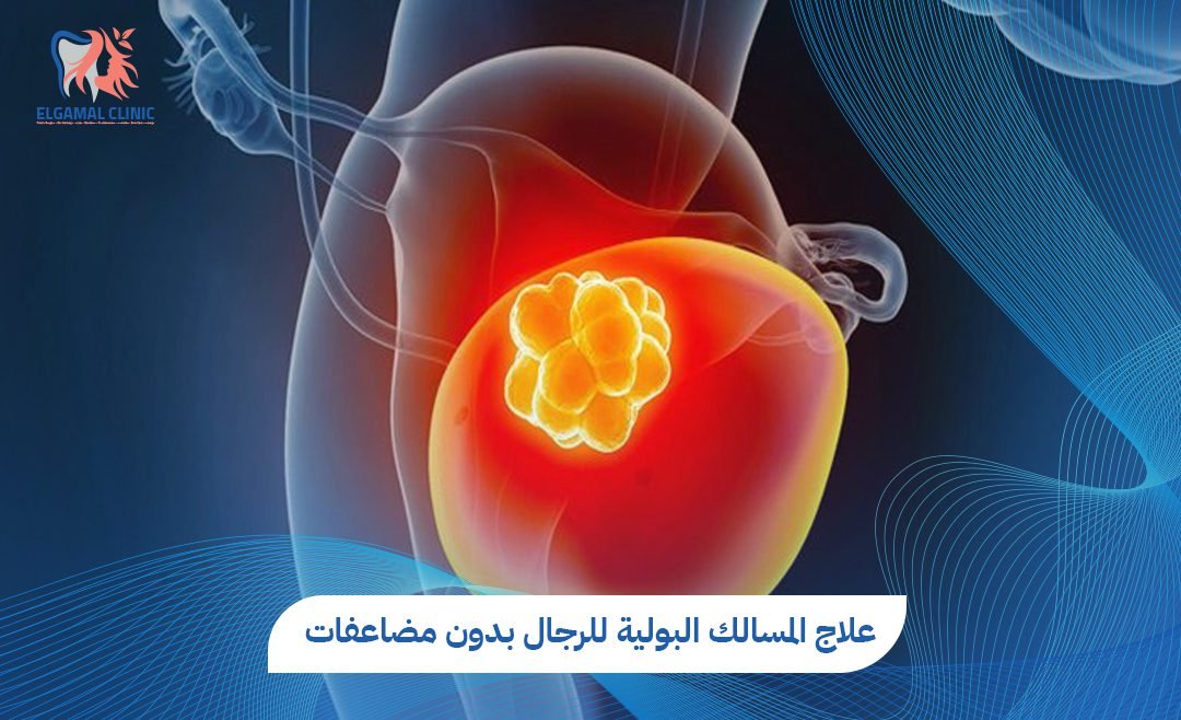 علاج المسالك البولية للرجال | عيادات الجمل