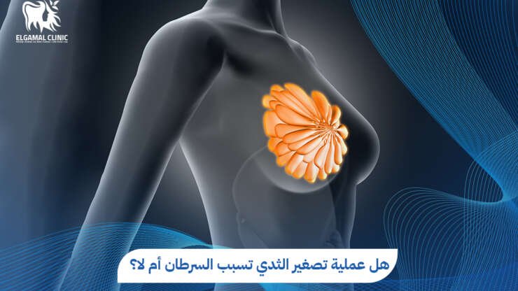 هل عملية تصغير الثدي تسبب السرطان؟ الحقيقة الكاملة من الأطباء