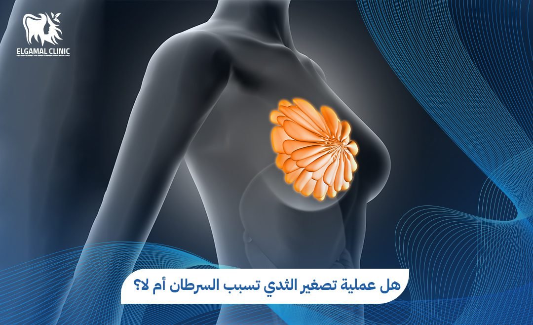 هل عملية تصغير الثدي تسبب السرطان؟ الحقيقة الكاملة من الأطباء
