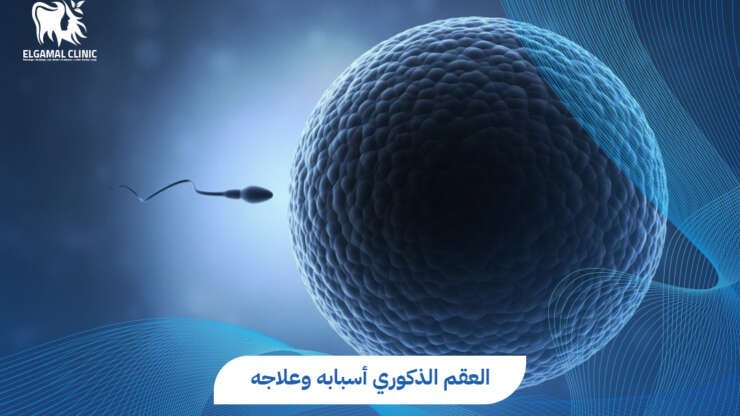 أسباب وعلاج العقم الذكوري | د. أحمد عاطف خلاف