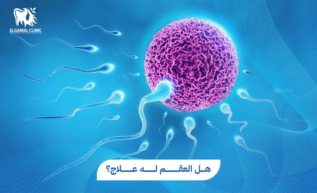 هل العقم له علاج؟ | د. أحمد عاطف خلاف