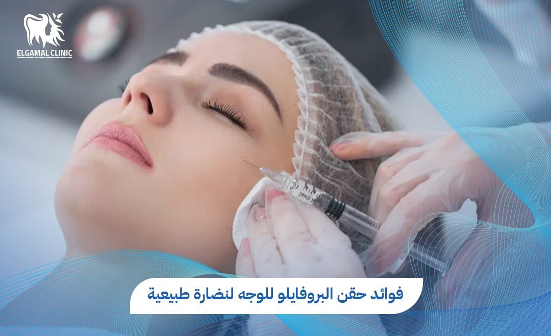 سعر حقن البروفايلو للوجه 2026 | عيادة الجمل