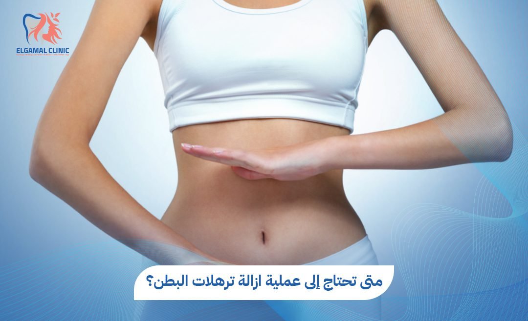 عملية إزالة ترهلات البطن | التكلفة والنتائج 2026 | د. أحمد لطفي الجمل