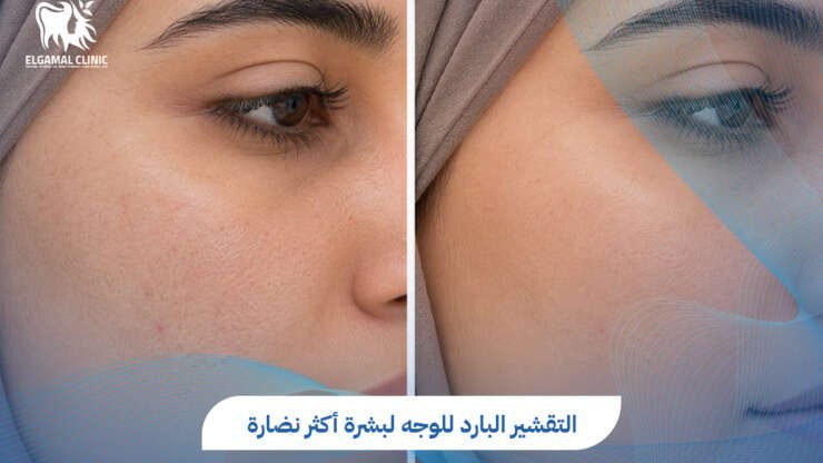 افضل انواع التقشير للوجه في القاهرة | عيادة الجمل