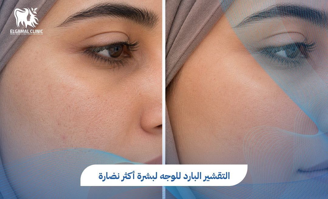 افضل انواع التقشير للوجه في القاهرة | عيادة الجمل