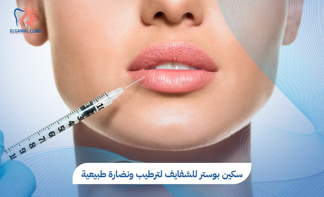 سكين بوستر للشفايف في القاهرة | 5 فوائد لترطيب ونضارة طبيعية