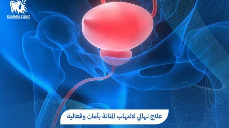 علاج التهاب المثانة في 5 خطوات | عيادات الجمل