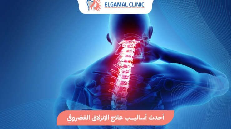 علاج الانزلاق الغضروفي بدون جراحة | عيادة الجمل