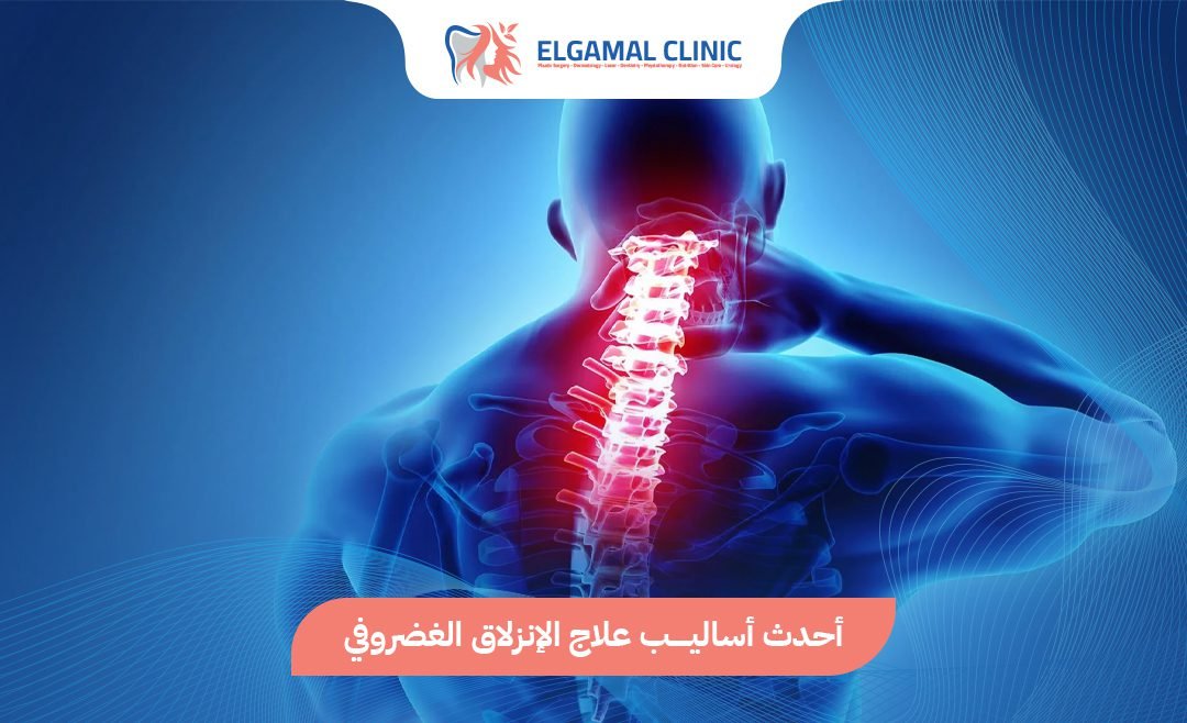 علاج الانزلاق الغضروفي بدون جراحة | عيادة الجمل