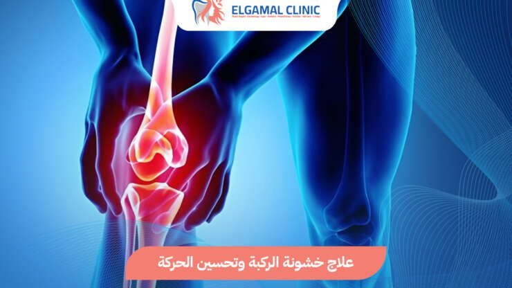 علاج خشونة الركبة بدون جراحة | عيادة الجمل