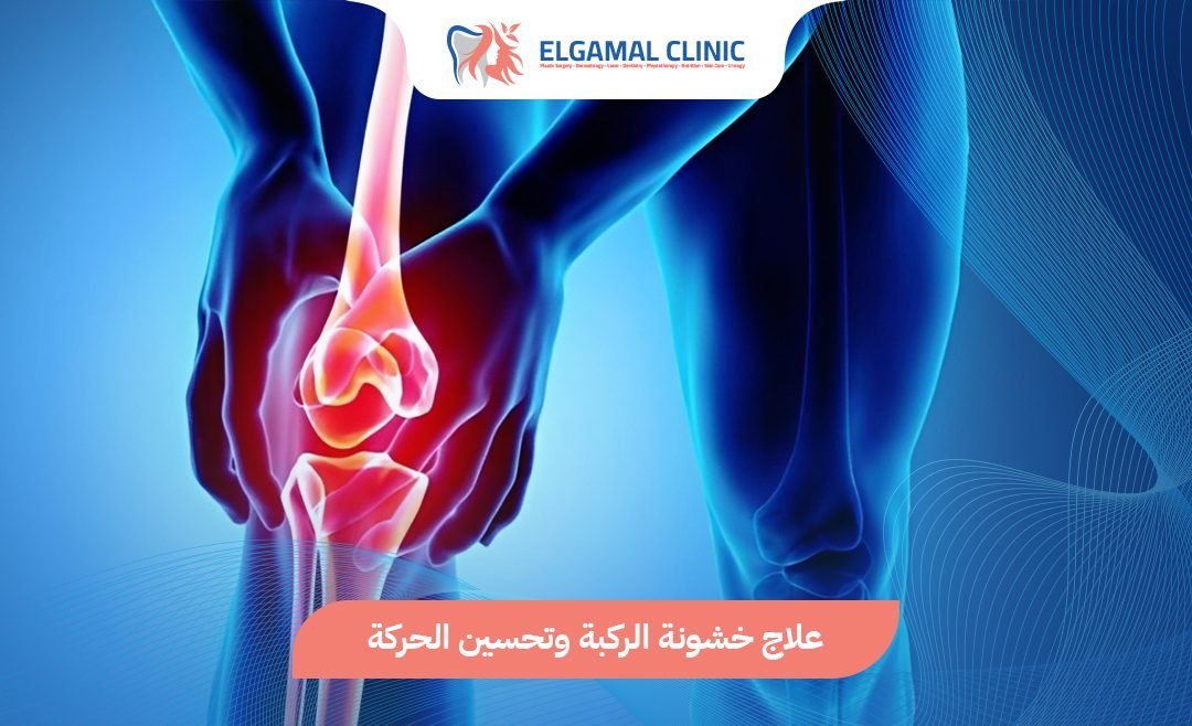 علاج خشونة الركبة بدون جراحة | عيادة الجمل