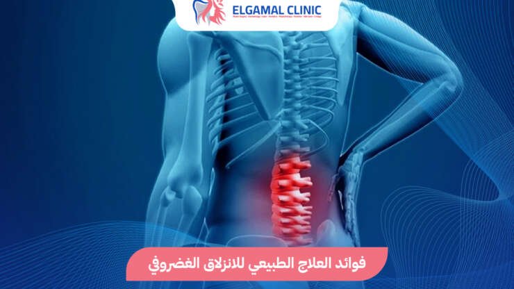 العلاج الطبيعي للانزلاق الغضروفي | عيادة الجمل