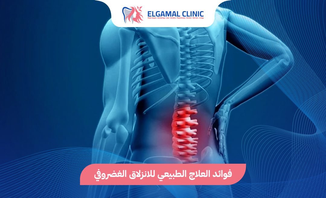 العلاج الطبيعي للانزلاق الغضروفي | عيادة الجمل